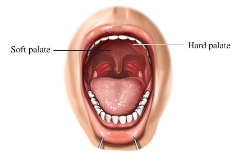 Soft Palate Mouth 117